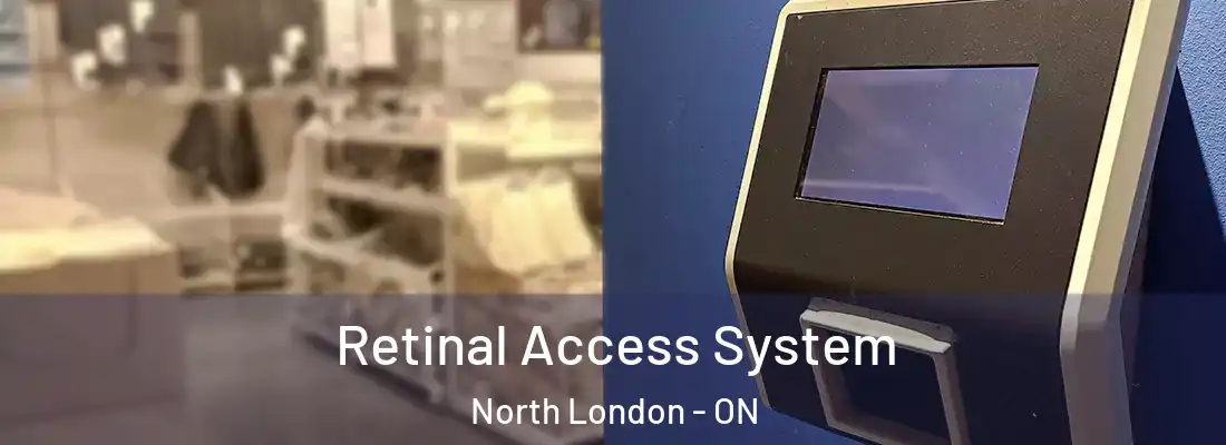  Retinal Access System North London - ON