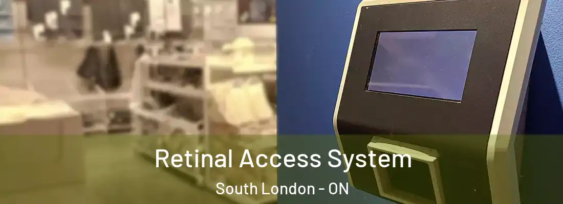  Retinal Access System South London - ON